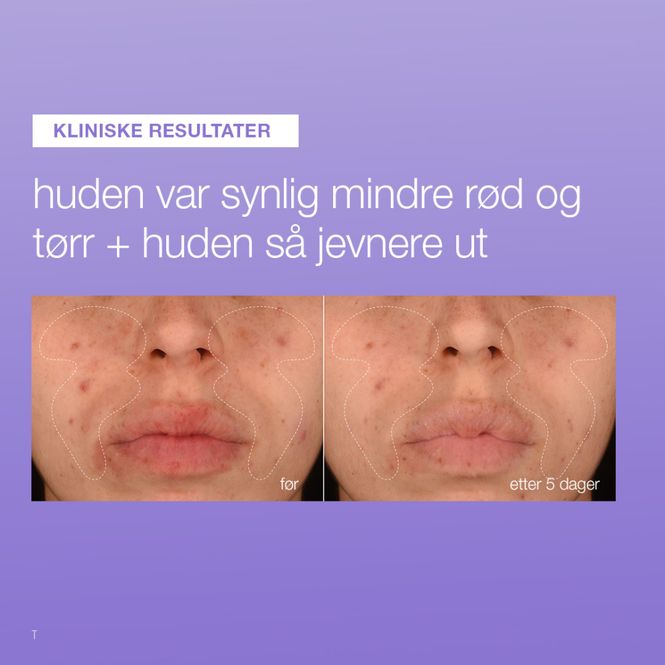 Hovedbilde Dermalogica Stabalizing Repair Serum 50ml